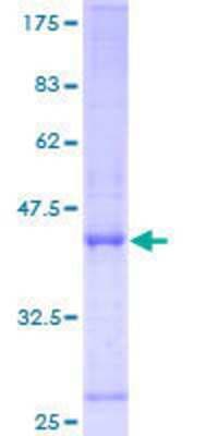 SDS-PAGE: Recombinant Human ORP150/HSP12A GST (N-Term) Protein [H00010525-P02]