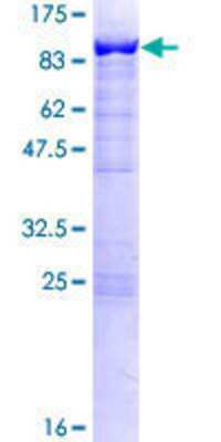 SDS-PAGE: Recombinant Human SWAP70 GST (N-Term) Protein [H00023075-P01]