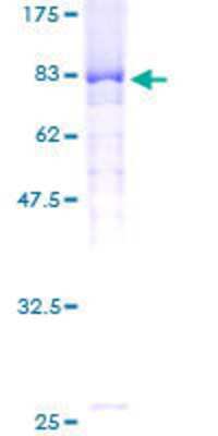 SDS-PAGE: Recombinant Human FBXW11 GST (N-Term) Protein [H00023291-P01]