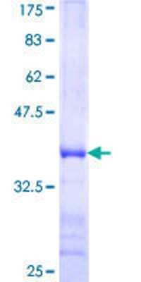 SDS-PAGE: Recombinant Human LARG GST (N-Term) Protein [H00023365-Q01]