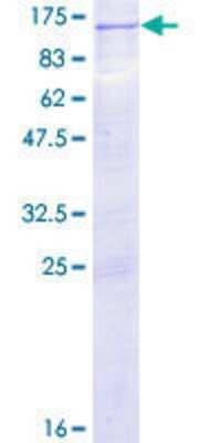 SDS-PAGE: Recombinant Human Protein Kinase D2 GST (N-Term) Protein [H00025865-P01]