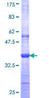 SDS-PAGE: Recombinant Human TRIM58 GST (N-Term) Protein [H00025893-Q01]