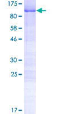 SDS-PAGE: Recombinant Human CCDC9 GST (N-Term) Protein [H00026093-P01]
