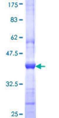 SDS-PAGE: Recombinant Human PIB5PA GST (N-Term) Protein [H00027124-Q01]