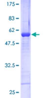 SDS-PAGE: Recombinant Human RNF141 GST (N-Term) Protein [H00050862-P01]