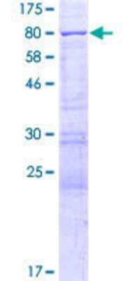 SDS-PAGE: Recombinant Human YTHDF2 GST (N-Term) Protein [H00051441-P01]