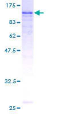 SDS-PAGE: Recombinant Human EPLIN GST (N-Term) Protein [H00051474-P01]