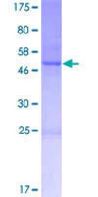 SDS-PAGE: Recombinant Human CNO GST (N-Term) Protein [H00055330-P01]