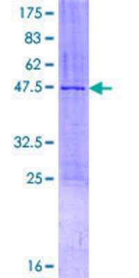 SDS-PAGE: Recombinant Human ZMAT5 GST (N-Term) Protein [H00055954-P01]