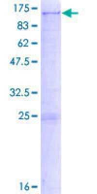 SDS-PAGE: Recombinant Human Sulfatase-2/SULF2 GST (N-Term) Protein [H00055959-P02]