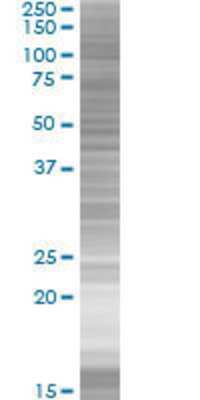 Other: Ebf4 293T Cell Transient Overexpression Lysate [H00057593-T01]