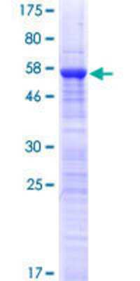 SDS-PAGE: Recombinant Human UVSSA GST (N-Term) Protein [H00057654-P01]