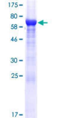 SDS-PAGE: Recombinant Human VAT1L GST (N-Term) Protein [H00057687-P01]