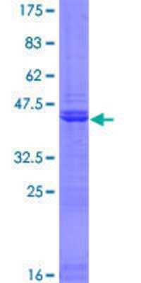 SDS-PAGE: Recombinant Human PHC3 GST (N-Term) Protein [H00080012-P01]