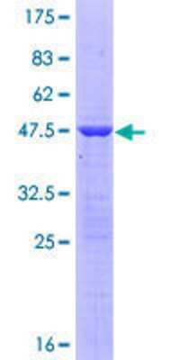 SDS-PAGE: Recombinant Human NTPCR GST (N-Term) Protein [H00084284-P01]
