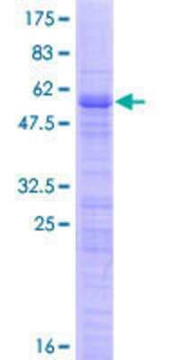SDS-PAGE: Recombinant Human TBRG1 GST (N-Term) Protein [H00084897-P01]