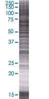 Other: Methionyl tRNA synthetase 2 293T Cell Transient Overexpression Lysate [H00092935-T01]