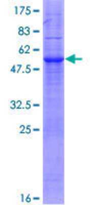SDS-PAGE: Recombinant Human MARCH3 GST (N-Term) Protein [H00115123-P01]
