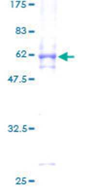 SDS-PAGE: Recombinant Human MAPK15 GST (N-Term) Protein [H00225689-P01]
