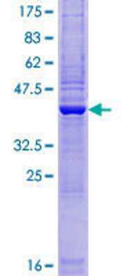 SDS-PAGE: Recombinant Human ZBTB8OS GST (N-Term) Protein [H00339487-P01]