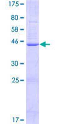 SDS-PAGE: Recombinant Human TMEM179B GST (N-Term) Protein [H00374395-P01]