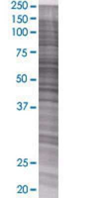 Other: FATP1/SLC27A1 293T Cell Transient Overexpression Lysate [H00376497-T01]