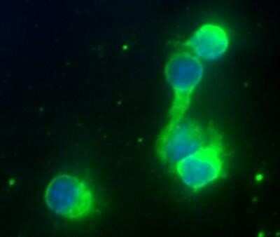 Immunohistochemistry: rRNA Antibody (Y10b) - Azide and BSA Free [NBP2-80932]