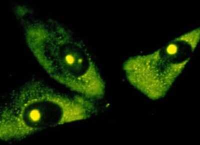 Immunocytochemistry/ Immunofluorescence: rRNA Antibody (Y10b) - BSA Free [NB100-662]