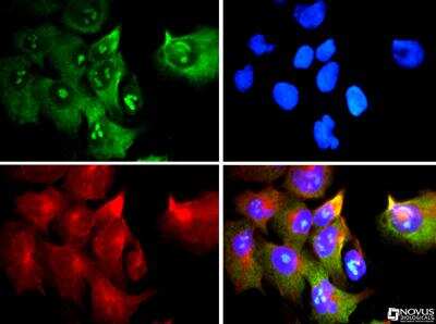 Immunocytochemistry/ Immunofluorescence: rRNA Antibody (Y10b) - BSA Free [NB100-662]