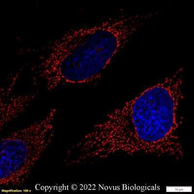 Immunocytochemistry/ Immunofluorescence: rRNA Antibody (Y10b) - BSA Free [NB100-662]