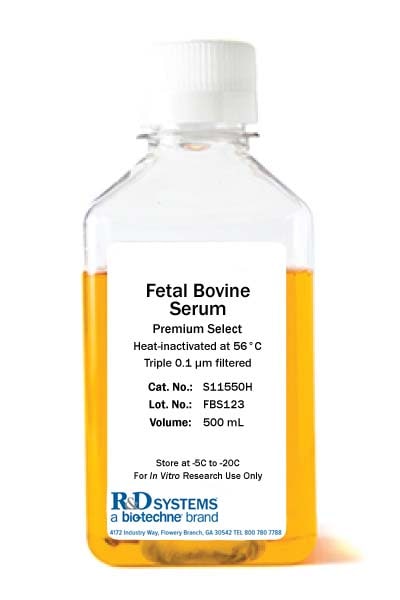 Fetal Bovine Serum - Premium Select, Heat Inactivated