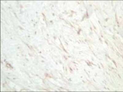 Immunohistochemistry: sFRP-1 Antibody [NB600-499]