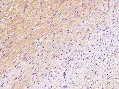 Immunohistochemistry-Paraffin: sFRP-1 Antibody [NBP2-99417]