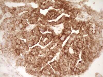 Immunohistochemistry: sFRP-2 Antibody (OTI6C2) - Azide and BSA Free [NBP2-74151]