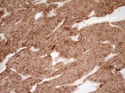 Immunohistochemistry: sFRP-2 Antibody (OTI6C2) - Azide and BSA Free [NBP2-74151]