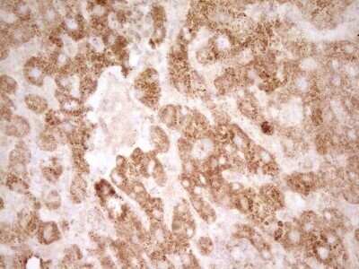 Immunohistochemistry: sFRP-2 Antibody (OTI6C2) - Azide and BSA Free [NBP2-74151]