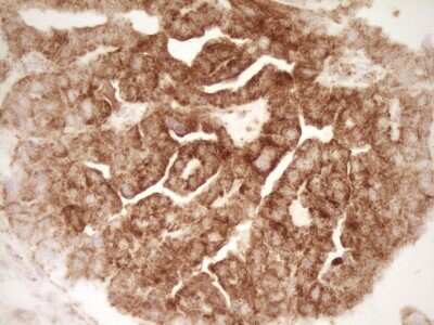 Immunohistochemistry: sFRP-2 Antibody (OTI6C2) [NBP2-45804]