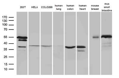 Western Blot: sFRP-2 Antibody (OTI6C2) [NBP2-45804]