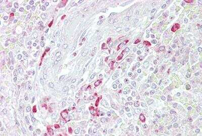 Immunohistochemistry-Paraffin: sFRP-3/FRZB Antibody [NBP1-79552]