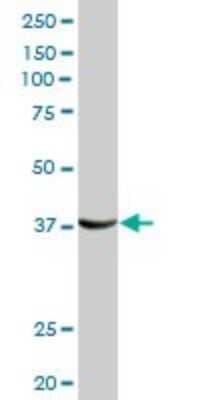 Western Blot: sFRP-3/FRZB Antibody [H00002487-D01P]