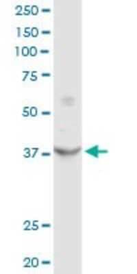 Western Blot: sFRP-3/FRZB Antibody [H00002487-D01P]