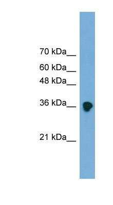 Western Blot: sFRP-3/FRZB Antibody [NBP1-79552]