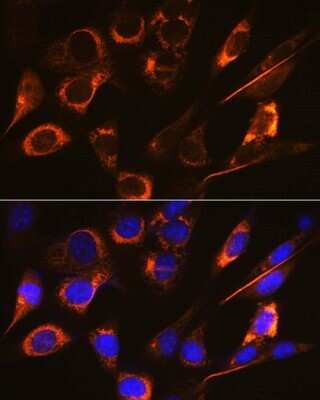 Immunocytochemistry/ Immunofluorescence: sFRP-4 Antibody (7Z6Q1) [NBP3-16352]