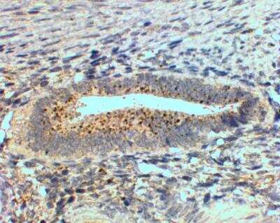 Immunohistochemistry-Paraffin: sFRP-4 Antibody [NBP1-36985]