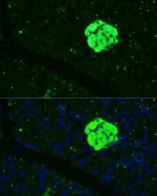 Immunohistochemistry: sFRP-5 Antibody - Azide and BSA Free [NBP2-94775]