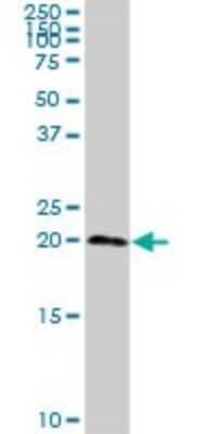 Western Blot: sen15 Antibody [H00116461-D01P]