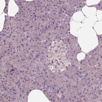 Immunohistochemistry-Paraffin: shootin-1 Antibody [NBP2-38374]