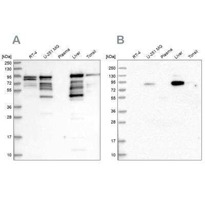 Western Blot: shootin-1 Antibody [NBP1-80753]