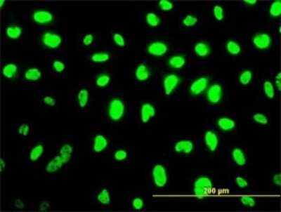 Immunocytochemistry/ Immunofluorescence: smu1 Antibody (2B12-2F2) [H00055234-M01]