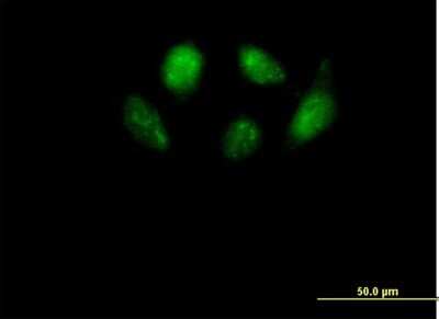 Immunocytochemistry/ Immunofluorescence: smu1 Antibody [H00055234-B01P]